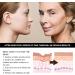 Face Moisturizer Face Cream Skin Care Beauty with Niacinamide & Retinol Removes Acne Redness Fade Dark Spots (100g) - Buy Online on GoSupps.com