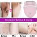 Lady Shaver 2.0 - 3-in-1 Wireless Women's Razor for Intimate Areas Bikini Trimming & Body Pink - Buy Online on GoSupps.com
