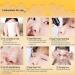 Deep Cleansing Blackhead Pore Strips - Effective Blackhead Remover for Nose Face Chin & Forehead - International Shipping Available - Buy Online on GoSupps.com