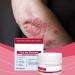 Cr me Hydratante Apaisante Visage Lotion Anti-D mangeaisons Douce 30g Produit Naturel Apaisant les Rougeurs pour Types de Peau - Buy Online on GoSupps.com