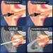 Ear Wax Removal Kit - Cleaner & Irrigation System - Black Ear Cleaning Tool - Buy Online on GoSupps.com