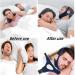 Buy Anti-Snoring Chin Strap for Better Sleep | Jaw Strap - Keep Mouth Closed Overnight (Blue+Black - Buy Online on GoSupps.com