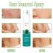 Heal Scar Care Spray | Advanced Formula for All Scar Types | 80g - International Shipping Available - Buy Online on GoSupps.com