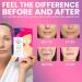 Miss Spa Reusable Silicone Smile Line Patches - 20x Hydrating & Smoothing Anti-Aging Overnight Wrinkle Patches - Dermatologist Tested - Buy Online on GoSupps.com