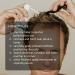 DS Laboratories StimuROLLER HAIR | Micro-Needle Hair Stimulation System 0.3mm - Boost Hair Growth | International Shipping Available - Buy Online on GoSupps.com