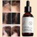 Anti-Hair Loss Oil | Hair Growth Product | Anti-Hair Products 60ml Nourishing and Strengthening Hair Growth Oil for Jingan - Buy Online on GoSupps.com