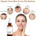 Retinol Serum for Face Retinol 0.2% in Squalane Reduce the Appearances of fine Lines of Photo Damage and of General Skin Ageing Acne Reduced Brighten & Smooth Skincare for Women & Men - Buy Online on GoSupps.com