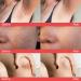Dark Spot Corrector Cream for Body, Neck, Underarm, Knees, Elbows, Inner Thigh & Private Parts - Upgraded Formula, Quick Results 60ML - Buy Online on GoSupps.com