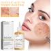 Glycolic Acid 7% Toning Solution Glycolic Acid Toning Resurfacing Solution Glycolic Sour 7% Toner for Blemishes and Acne Facial Exfoliation Moisturize & Strengthen Skin Water Toner (100ml) - Buy Online on GoSupps.com