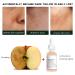 10% Lactic Acid Serum with Hyaluronic Acid & Vitamin C | Shrink Pores Hydrate & Even Skin Tone - Buy Online on GoSupps.com