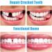 INBOLM Temporary Tooth Filling Repair Kit - DIY Moldable False Teeth Repair Granules - Buy Online on GoSupps.com
