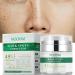 Dark Spot Remover for Face & Body Dark Spot Remover Hyperpigmentation Treatment Freckle Removel Cream with Plant Extract Spot Cream for All Skin Types 50 ml /1.7 fl oz - Buy Online on GoSupps.com
