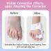 Bunion Corrector for Kids - Adjustable Orthopedic Toe Straightener & Splint for Hallux Valgus Relief (1 Pair - Buy Online on GoSupps.com