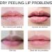 Lip Repair - Lip Care - Moisturizing Lip Balm (Pink) - Sweet Lip Balms - Nourishing Lip Oil - Lip Moisturizer for Teen Girl Gifts - Makeup Base Lip Butter - Cute Natural Lip Gel - Buy Online on GoSupps.com
