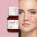 Bielenda Dr Medica - Effectively Reduces The Visibility Of Capillaries Brightens Discolorations - Dr Medica Capillary Skin Dermatologic Anti-Redness Face Serum Day/Night - 30 ml - Buy Online on GoSupps.com