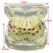 Dental Orthodontic Demonstration Model - Arch Wire Metal Bracket for Teaching & Study (Clear) | International Shipping - Buy Online on GoSupps.com