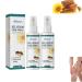 30ml Cvreoz Bee Venom Warts and Button Removal Treatment Spray Cvreoz Bee Venom Spray Against Warts (2PCS)