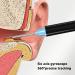 Yuyte Ear Cleaner - 2MP Wax Removal Tool with LED Light 360 Wide-Angle Lens Silicone Tip Dustproof & Waterproof - Buy Online on GoSupps.com