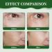 LFCFBH Advanced Firming & Wrinkle-Reducing Cream Multi-purpose Retinol Face & Body Moisturizer Anti-Wrinkle Cream for All Skin - Buy Online on GoSupps.com