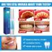 Teeth Whitening Pen Set - Effective Rotary Tooth Stain Remover Gentle Formula for Sensitive Teeth 3PC - Achieve a Radiant Smile! - Buy Online on GoSupps.com