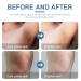 Skin Bleaching Cream for Body | Dark Spot Remover & Skin Lightening for Intimate Areas Underarms Knees Elbows & More - Buy Online on GoSupps.com