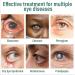 S rum Nano pour les yeux gouttes pour les yeux de presbytie s rum pour soulager la fatigue des yeux et am liorer la vision doux et efficace (2) - Buy Online on GoSupps.com