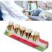 Realistic Dental Periodontitis Model - Study Dental Teeth in Various Stages | Synthetic Resin Educational Tool - Buy Online on GoSupps.com