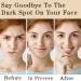 Dark Spot Corrector Cream - Remove Dark Spots on Face & Body | Collagen & Niacinamide | Instant Results | 2 oz - Buy Online on GoSupps.com
