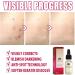 Aibyks 2 Skin Tag Corrector | Natural Mole Remover Cream Natural Skin Tag Removal Mole Corrector for Face Wart and Body Wart - Buy Online on GoSupps.com