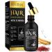 5% Minoxidil for Men and Women Hair Growth Oil Minoxidil Hair Growth Serum Infused with Biotin for Hair Regrowth Treatment Scalp Hair Loss Hair Thinning Natural Hair Growth 2.02 oz