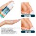 Postpartum & Burn Scar Treatment Gel 50ML - Smooth Skin & Diminish Scars - Blue - Buy Online on GoSupps.com