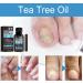 Solution nourrissante pour r paration des ongles d'orteils - 30 ml - Solution de r paration longue dur e pour le bain la maison le salon de p dicure manucure de nuit voyage - Buy Online on GoSupps.com