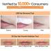 Facial hair removal cream - gentle hair removal cream for sensitive skin | Moisturizing hair remover for the chin and upper lip | Hair removal cream - Buy Online on GoSupps.com