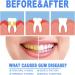 Gum Shield Therapy Gel de protection des gencives Gel th rapeutique pour gencives Repain Protect et gouttes - Buy Online on GoSupps.com