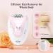 QFS Epilator 2 - Women's Facial & Body Hair Removal Device - Buy Online on GoSupps.com
