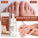 GFOUK 7 Days Nail Growth and Strength Serum Set - Nail Repair and Growth Oil for Toenail Treatment (2 Pcs) - Buy Online on GoSupps.com