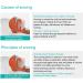 Portable Anti Snoring Solution Device for Easy Breathing - Professional & Effective (Blue) - Buy Online on GoSupps.com