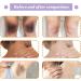 Dark Spot Remover Cream Anti Dark Spot Pigment Spot Remover Dark Spot Remover for Inner Thighs Skin Brightening Cream Face Cream for Correcting Dark Spots - Buy Online on GoSupps.com