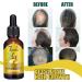 S rum de Croissance des Cheveux au Gingembre Hydrate La Pousse Des Cheveux S rum Croissance Cheveux S rum Pousse Cheveux Tr s Rapide pour Les Cheveux Fins Pr vention de La Chute des Cheveux 20ML - Buy Online on GoSupps.com