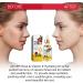 Vitamin E Oil - Rose Face & Body Oil for Dry Skin Wrinkle Reduction Scars Stretch Marks | Gentle Formula - 2.02 Oz - Buy Online on GoSupps.com