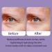 Ebanel Peptides Eye Serum for Dark Circles & Puffiness | Under Eye Treatment for Women & Men | Eye Lifting & Firming Serum with Wine, Lavender & Olive Leaf Extracts - Buy Online on GoSupps.com