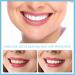 Customizable Temporary Teeth Veneers - Fake Top Teeth for Whitening | 2 Pieces Dental Veneers with Mini Tweezer - Buy Online on GoSupps.com