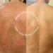 DRMTLGY 12% AHA Skin Lotion for Rough, Bumpy, KP, Dry Skin & Folliculitis - 6.9 Fl Oz - Buy Online on GoSupps.com