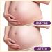 AOAO Shea Body Butter for Stretch Marks Pregnancy with Honey & Coconut - Shea Butter Body Balm & Body Butter for Pregnant Women - Hypoallergenic Nourishing Body Moisturizer (Shea Butter) - Buy Online on GoSupps.com