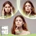 AUSLKA Blemishes Patches - 44 Strips Hydrocolloid Dots - Large Blemishes Patch - Blemishes Stickers - Zit Breakouts - Suitable for Larger Area Outbreaks 1 count (Pack of 44) - Buy Online on GoSupps.com