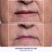 Wrinkles Schminkles Mouth & Lip Wrinkle Patch - Silicone Smoothing Pads for Lip Wrinkle Prevention - 1-Pack, Hypoallergenic & Reusable - 1 Count - Buy Online on GoSupps.com