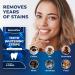 Professional Teeth Strips 7 Treatments - Enamel Safe - Non-Sensitive Formula - 14 Peroxide-Free Whitening Strips - Dentist Formulated Teeth Whitening Kit - Buy Online on GoSupps.com