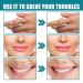 Skinetic Peach Fuzz Hair Removal Cream - Gentle & Painless Facial Hair Removal for Women (100g) - Buy Online on GoSupps.com