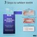 MasterMedi Non-Sensitive Teeth Whitening Strips - Fast-Result Stain Removal Kit - 56 Strips/28 Treatments - Buy Online on GoSupps.com