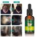 Ginger Hair Growth Serum - Stronger, Thicker, Longer Hair - Thinning Treatment - 3 Pack 30ML - Buy Online on GoSupps.com